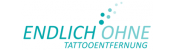 ENDLICH OHNE Tattooentfernung